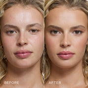 Before and after comparison of a woman's face with visible skin improvement.