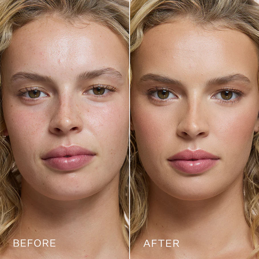Before and after comparison of a woman's face with visible skin improvement.